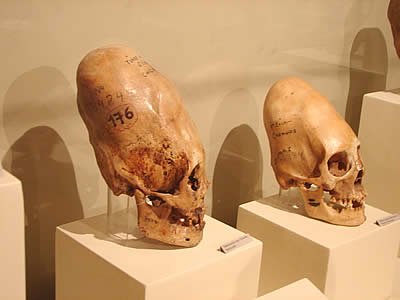 MUSEO REGIONAL DE ICA DEFORMACION CRANEO 03